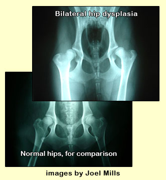 Hip Dysplasia